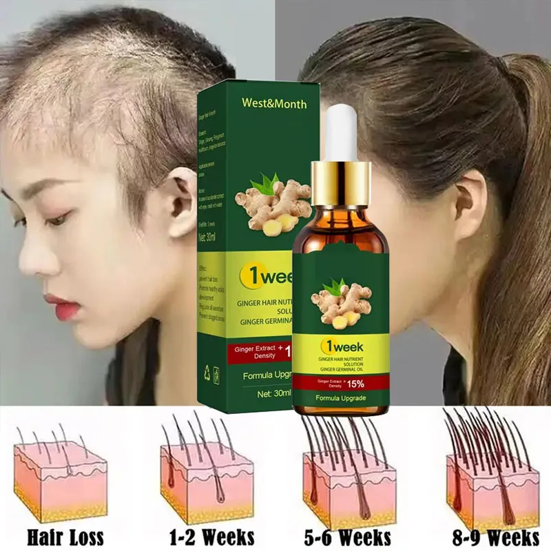 Licorice Root Sticks - زيوت أساسية مضادة لتساقط الشعر ،