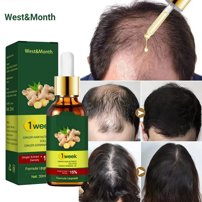 زيوت أساسية مضادة لتساقط الشعر - مراجعة Licorice Root Sticks وسعره