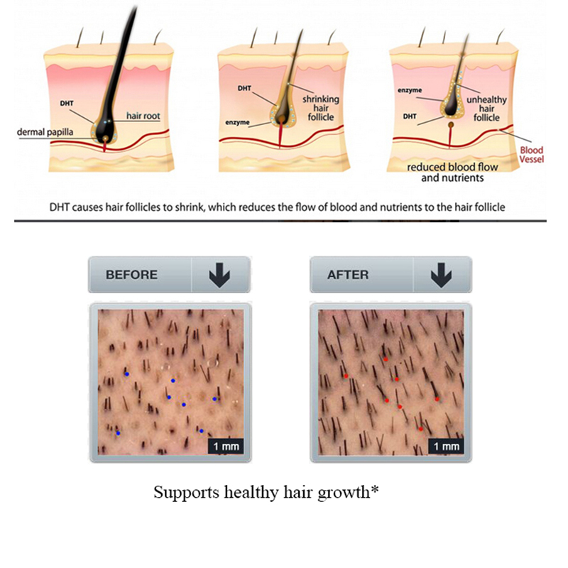 بورك-شامبو تساقط الشعر بالزنجب - مراجعة Licorice Root Sticks وسعره